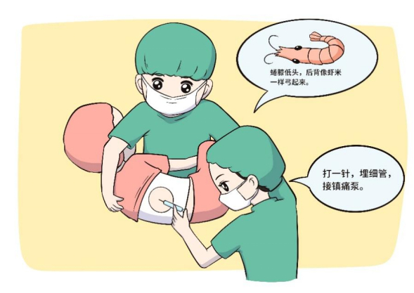 别再妖魔化无痛分娩|分娩|准妈妈|镇痛_新浪新闻