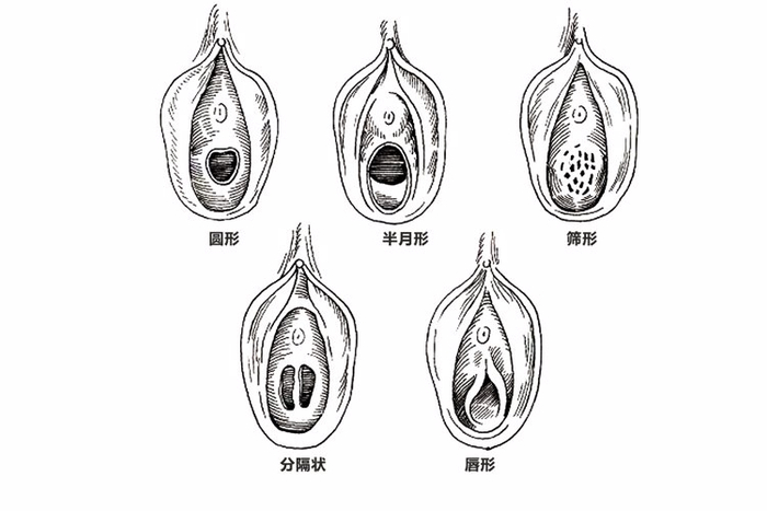 女人"下面"颜色深,就是经历太多了?别被男人给"洗脑"了