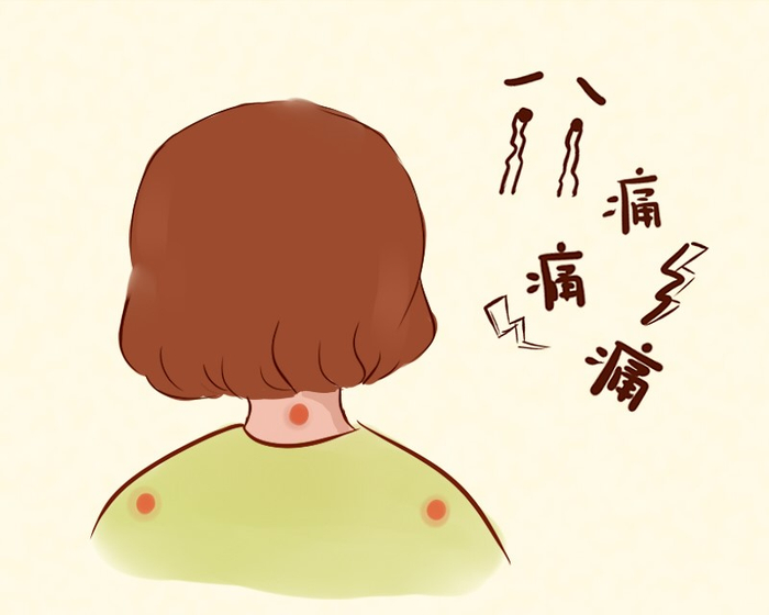 一觉醒来落枕了?别乱按,做好这4点可有效缓解不适!