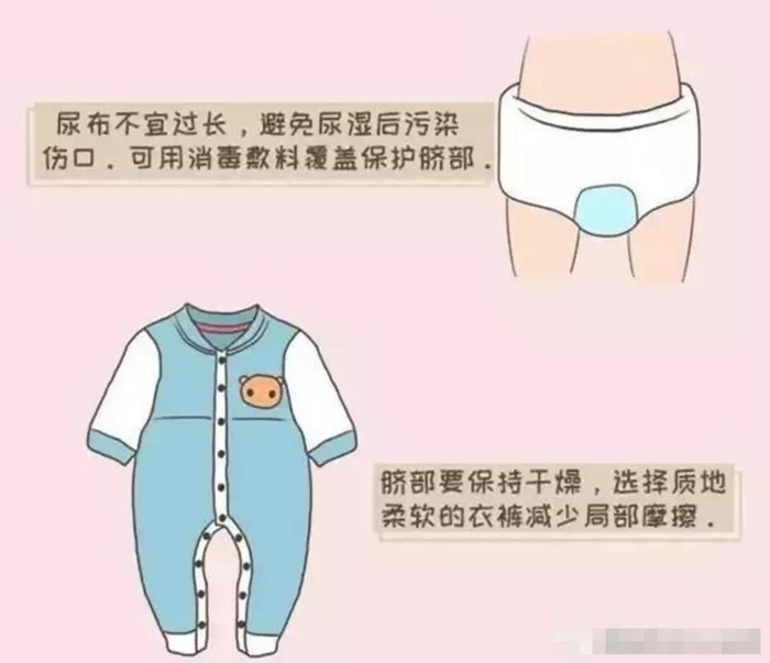 愈脐带怎么用视频新生宝宝脐带不会护理怎么办?_新闻资讯_第3张_活检穿刺产品网 愈脐带怎么用视频新生宝宝脐带不会护理怎么办?_https://www.jmylbn.com_新闻资讯_第3张