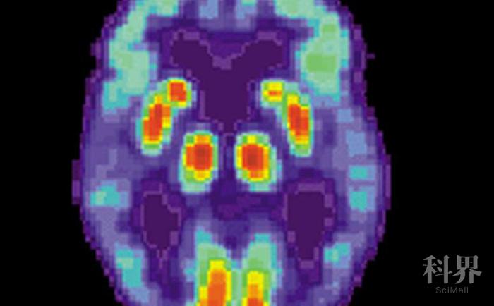 科学家开发了老年痴呆症的快速药物测试平台