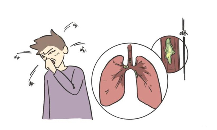 中医认为百病皆于痰?化痰能防治4种疾病,别不当回事!