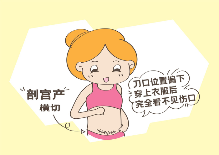 剖腹产选择竖切还是横切，原来这里有学问，不要盲目选择！|剖腹产|顺产|刀口|伤口|露脐装_新浪新闻