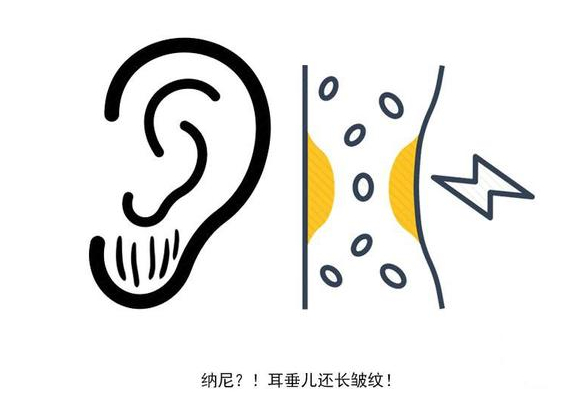 心电图机平板怎么使用耳朵褶皱是冠心病的信号？医生：真正诊断冠心病的方式只有这3种_https://www.jmylbn.com_新闻资讯_第2张