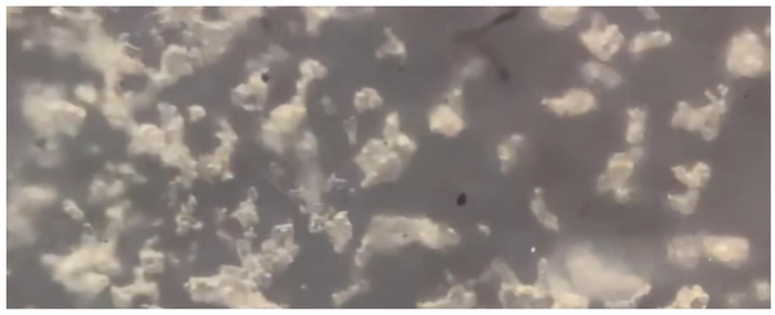 愈脐带怎么用视频为什么不能乱抠肚脐眼?原来肚脐眼连的根本不是肠子,终于弄懂了_新闻资讯_第5张_活检穿刺产品网 愈脐带怎么用视频为什么不能乱抠肚脐眼?原来肚脐眼连的根本不是肠子,终于弄懂了_https://www.jmylbn.com_新闻资讯_第5张