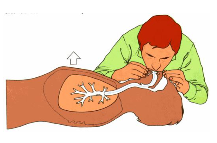 心肺仪是什么心肺复苏——对“时间就是生命”最好的诠释！_https://www.jmylbn.com_新闻资讯_第8张