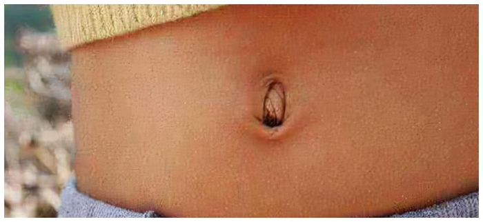 愈脐带怎么用视频为什么不能乱抠肚脐眼?原来肚脐眼连的根本不是肠子,终于弄懂了_新闻资讯_第6张_活检穿刺产品网 愈脐带怎么用视频为什么不能乱抠肚脐眼?原来肚脐眼连的根本不是肠子,终于弄懂了_https://www.jmylbn.com_新闻资讯_第6张