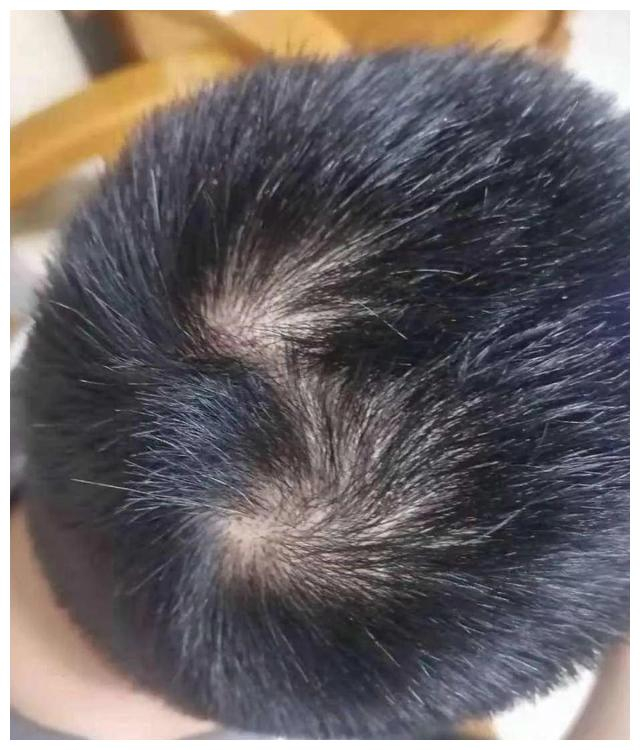 你头顶几个旋?有三个的不是一般人!飞黄腾达没问题|此人|财运|心理|大业|古书_新浪新闻