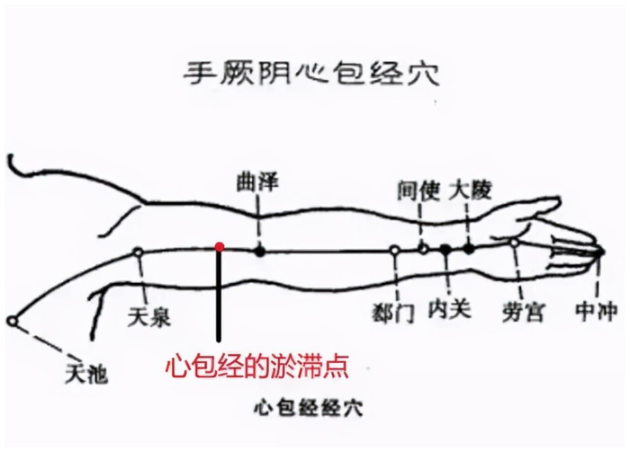 心包经——心脏的保护神!很多人不知道的淤滞点,居然有大作用|心梗|乳腺增生|天池|天泉|曲泽_新浪新闻