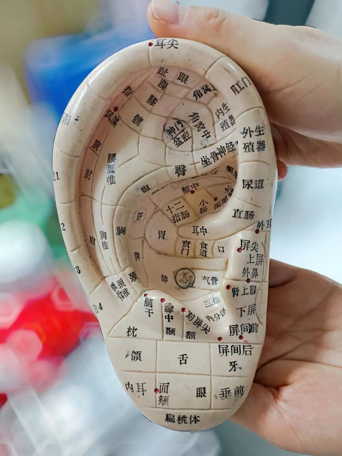 耳穴压豆科普来啦!|耳朵|王不留行|神门_新浪新闻