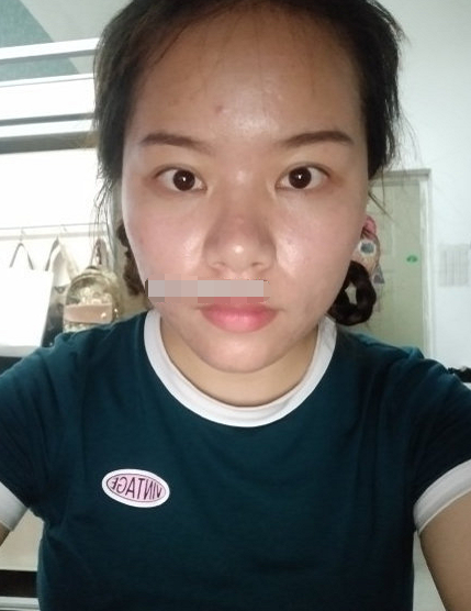 鼻头肉厚,财运很好,人中宽广,被身边人信赖