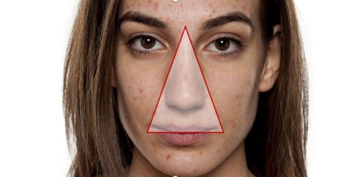 什么是面部危险三角区?