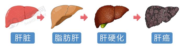 腹部的位置,正常情況下摸起來是綿軟的,如果出現腹部疼痛且摸起來很硬