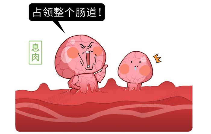 肠道里长了息肉,上厕所时会有5个提示,别等到晚期了才反应过来