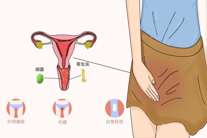 55岁女子确诊外阴癌她的坏习惯为所有人敲响警钟值得借鉴