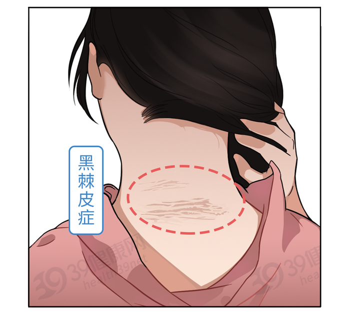 提醒:脖子出现3个异常,可能是癌症预警|癌症|脖子|肿块_新浪新闻