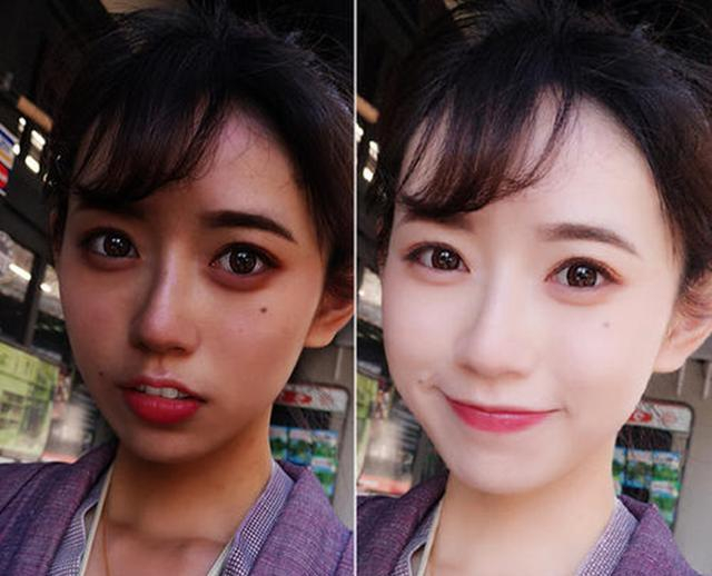 晒黑之后多久能恢复?怎么快速变白回来?