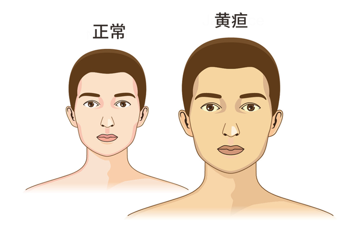 别以为就是缺水,可能是这5种病"找上门"了|干燥综合征|症状|患者_新浪