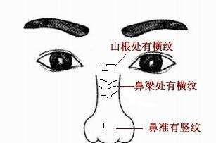 鼻子上长这些“纹印”对命运有什么影响?