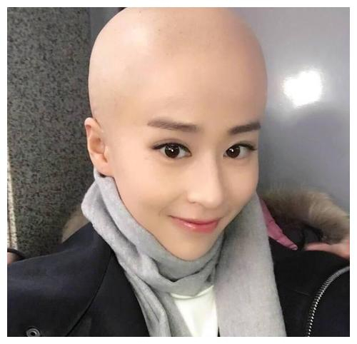 女星影视剧光头造型大合集，你觉得哪位最美呢？