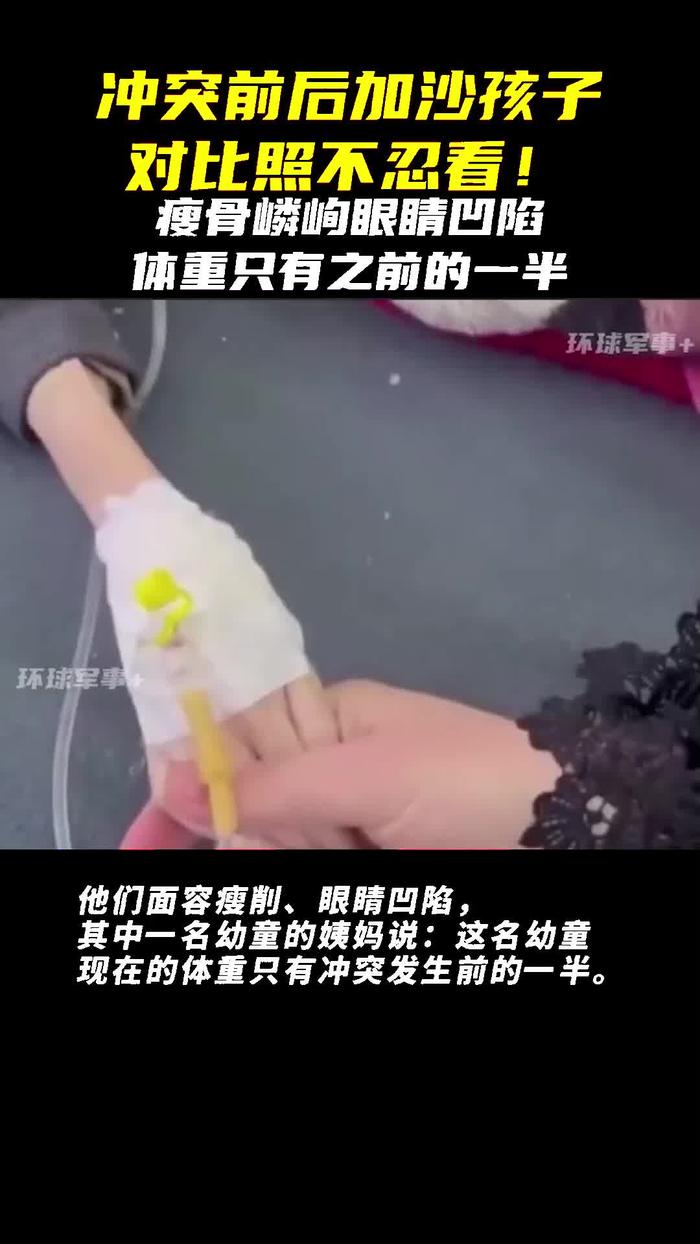 瘦骨嶙峋 孩子图片