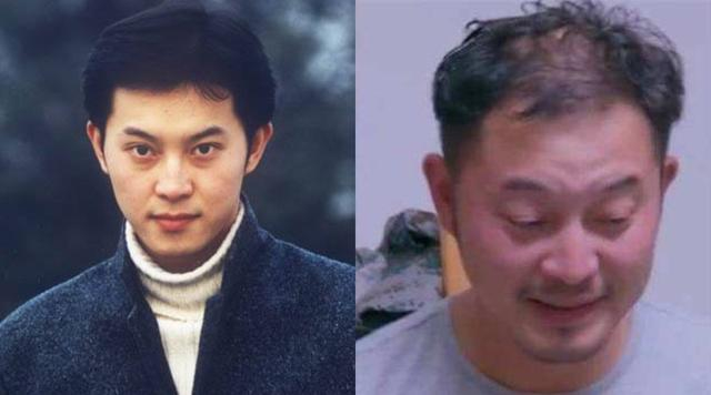 太秃然！再帅气也逃不掉秃头的10大男明星，第八位掩饰40多年
