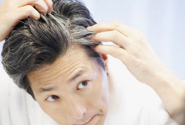 长白发与哪些因素有关?哪些食物有助于黑发生长?|老年人|白头发|白发|黑发|两鬓|毛囊|后脑勺|头发|前额|反射区|脾胃_新浪新闻