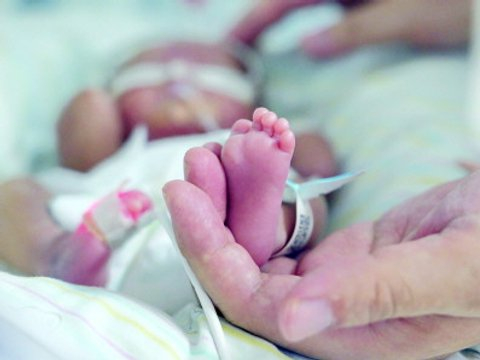 850克超早产儿105天的生命保卫战