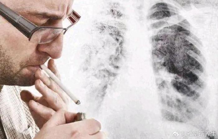 戒烟成功后,肺还可以恢复到正常状态吗?建议烟民朋友多了解