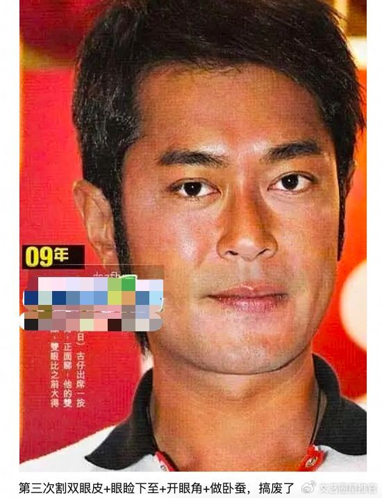 53岁古天乐近照遭吐槽凶神恶煞,被质疑打针拉皮过度导致医美失败