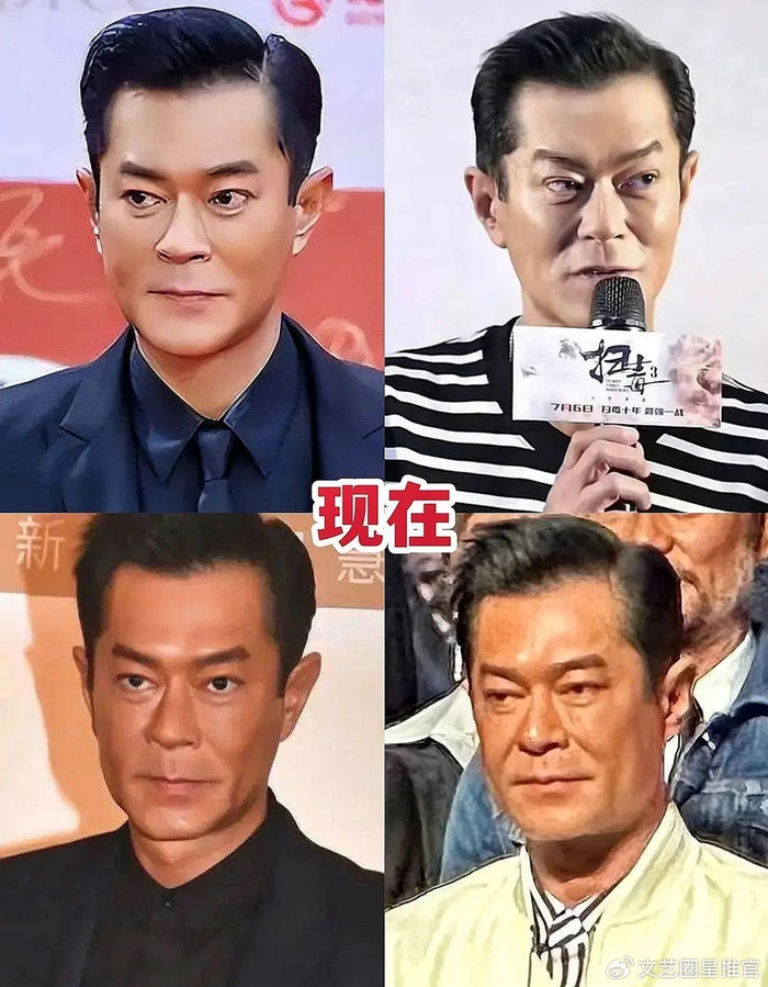 53岁古天乐近照遭吐槽凶神恶煞,被质疑打针拉皮过度导致医美失败|还是觉得你最好|娱乐圈|整容|外貌|公益_新浪新闻