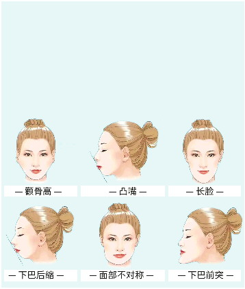 “整”救牙颌面:让颜值从“齿”开挂|牙齿|牙颌面畸形|口腔|颌骨|畸形_新浪新闻