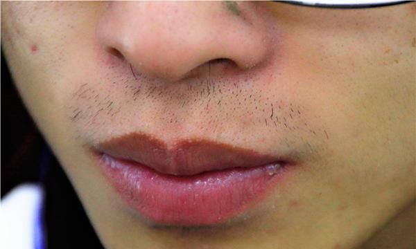 为什么刮胡子会刮出血为什么在线