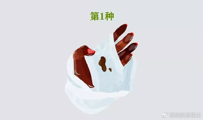 这种情况很多人都遇到过,通常是陈旧性出血流到内裤上形成的景象,对于