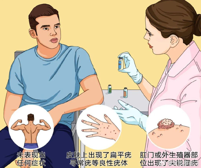 hpv不是女性"专属病毒",薇润提醒25%男性至少感染过1种高危型hpv!