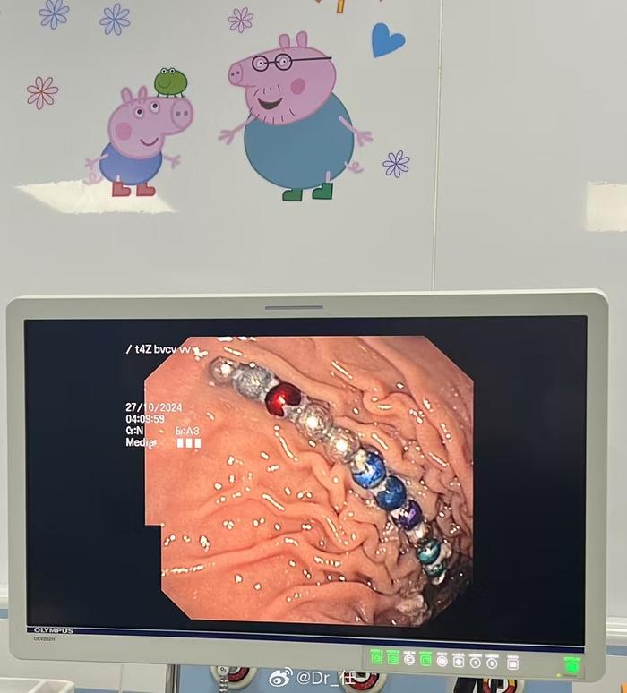 磁力珠子=磁力珠子不小心掉进了笔盖里怎么办