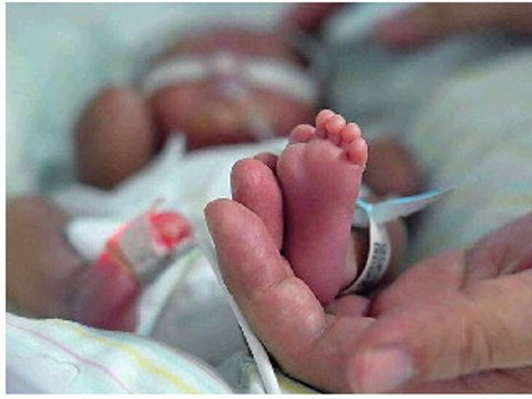 850克超早产儿105天的生命保卫战