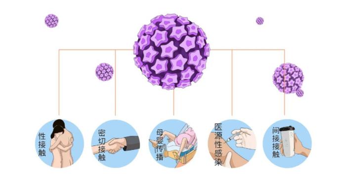 感染hpv后，子女等亲属是否有可能被传染？薇润来解答