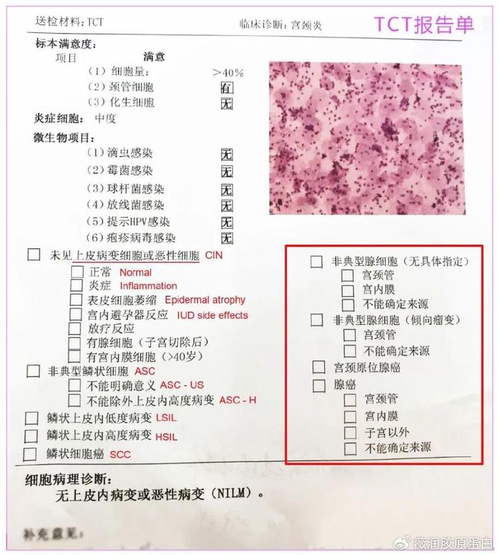 tct多少钱图片