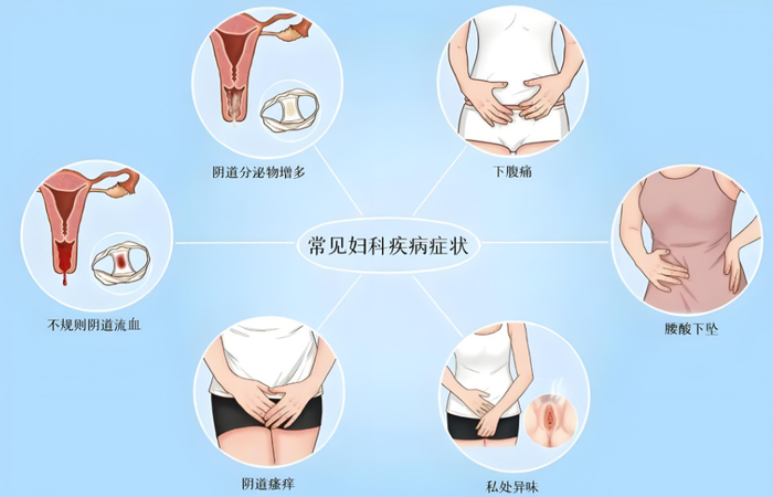 特别地,滴虫性阴道炎和念珠菌性阴道炎等妇科疾病,可因性行为而加重或