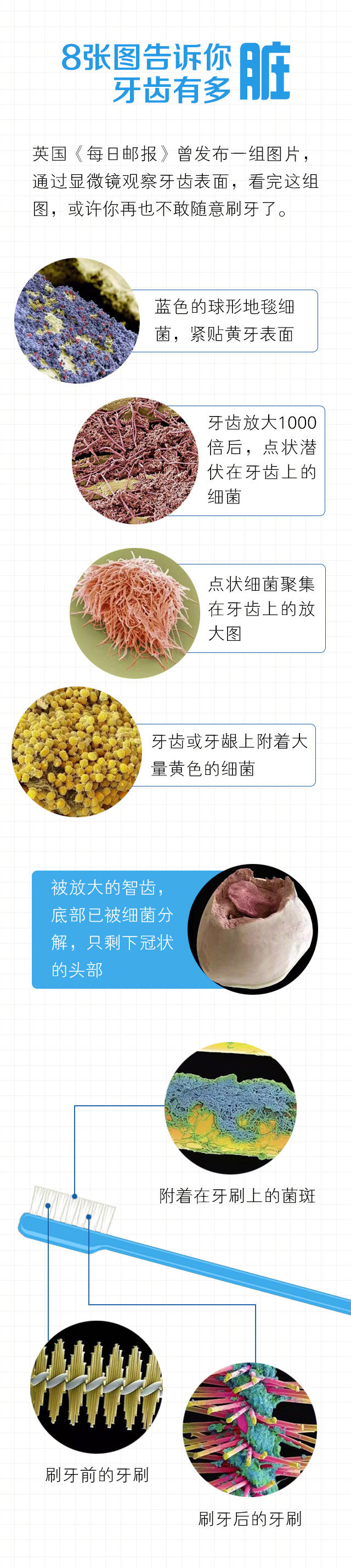牙齿放大1000倍长什么样?看完我决定认真刷牙了