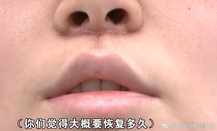 医疗|医疗美容|医院_新浪新闻