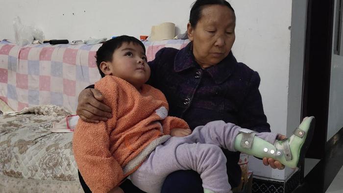 女子孕期发病致双胞胎女儿早产，两姐妹同胎降生，命运却天差地别