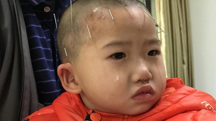 一家四口三人残疾，孙女出生后又遭重病缠身，老人艰难扛起整个家