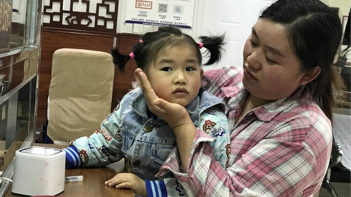 漂亮女童不会咀嚼,只能吃妈妈嚼过的饭菜,为凑治疗费爸爸累垮身体