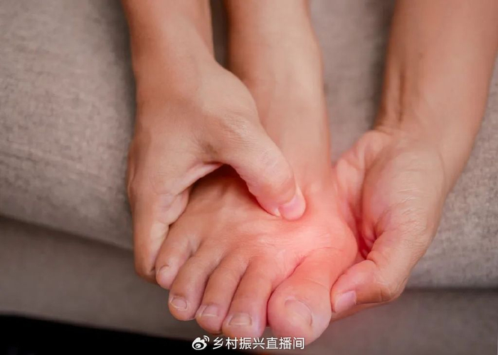 轻度拇外翻角度小于20°,可以通过保守方法来治疗,包括佩戴拇外翻矫正