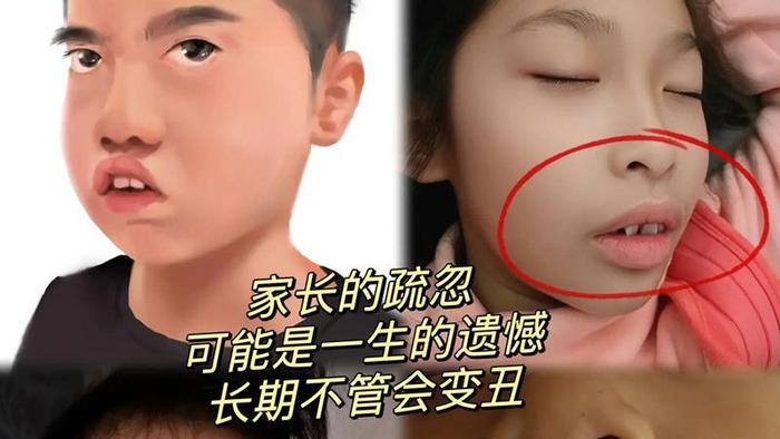 变丑警告！9种行为可能会毁了宝宝的颜值，及时纠正并转给老人看
