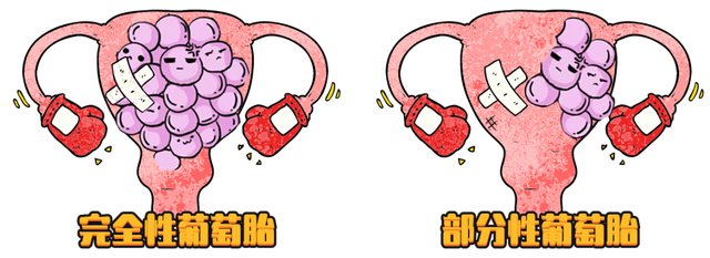 问医生:患部分性葡萄胎到底是谁的问题?