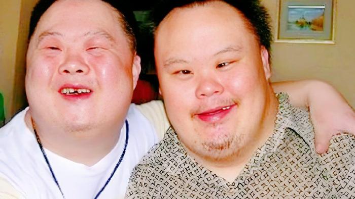 为啥“唐氏儿”几乎长着同一张脸？与这个原因有关系，爸妈要明白