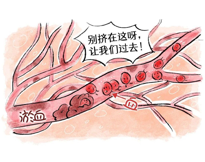 当代人有个通病,既血瘀又血虚!用这碗汤打通气血,气血一通百病消